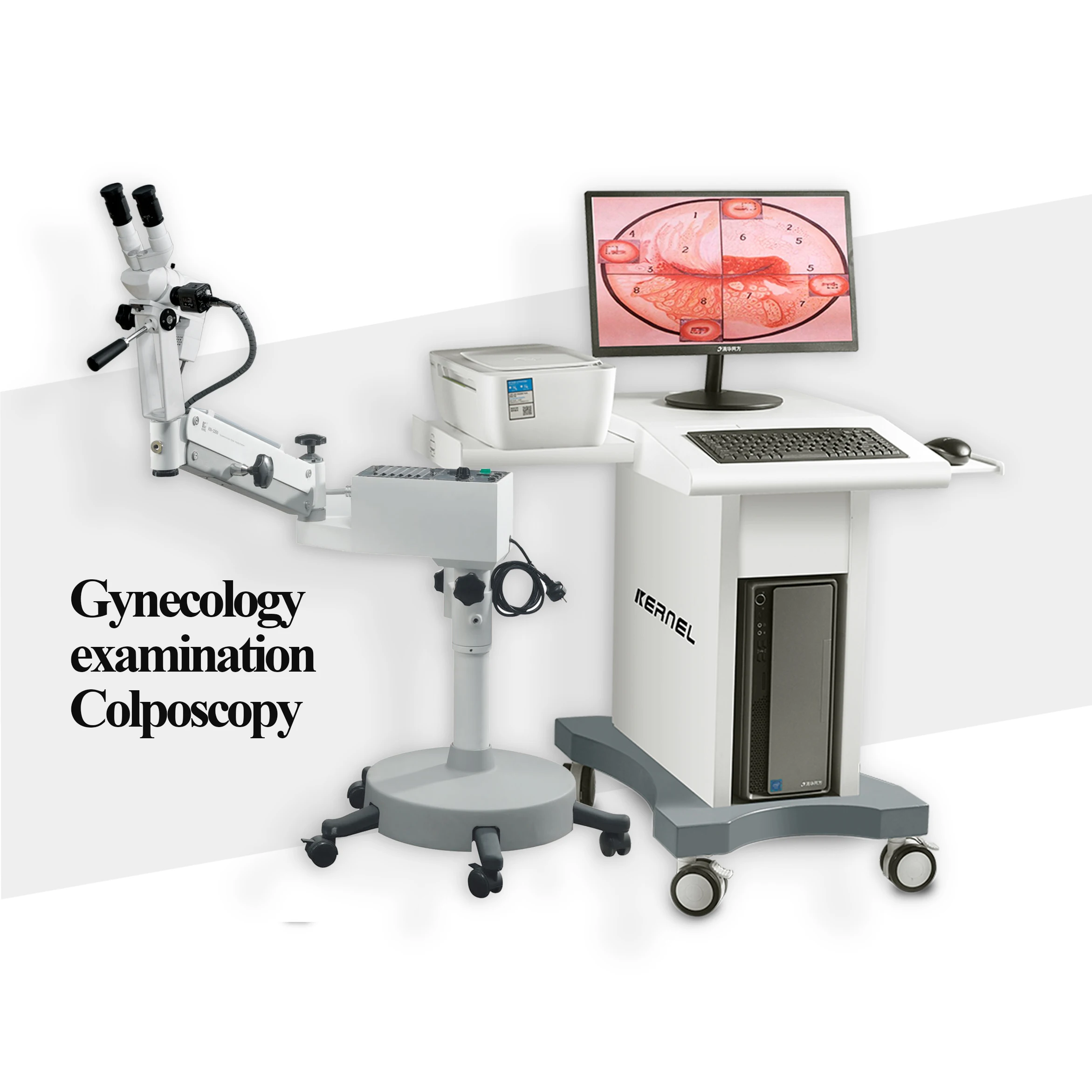 Hot selling Microscope Obstetrics Colposcope Optical Colposcope Binocular Microscope Colposcopy Kernel KN-2200
