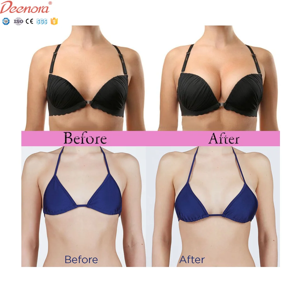 Deenora Hot Sale korean syringe cross linked injection breast  buttock enlargement knee under eye hyaluronic acid dermal filler