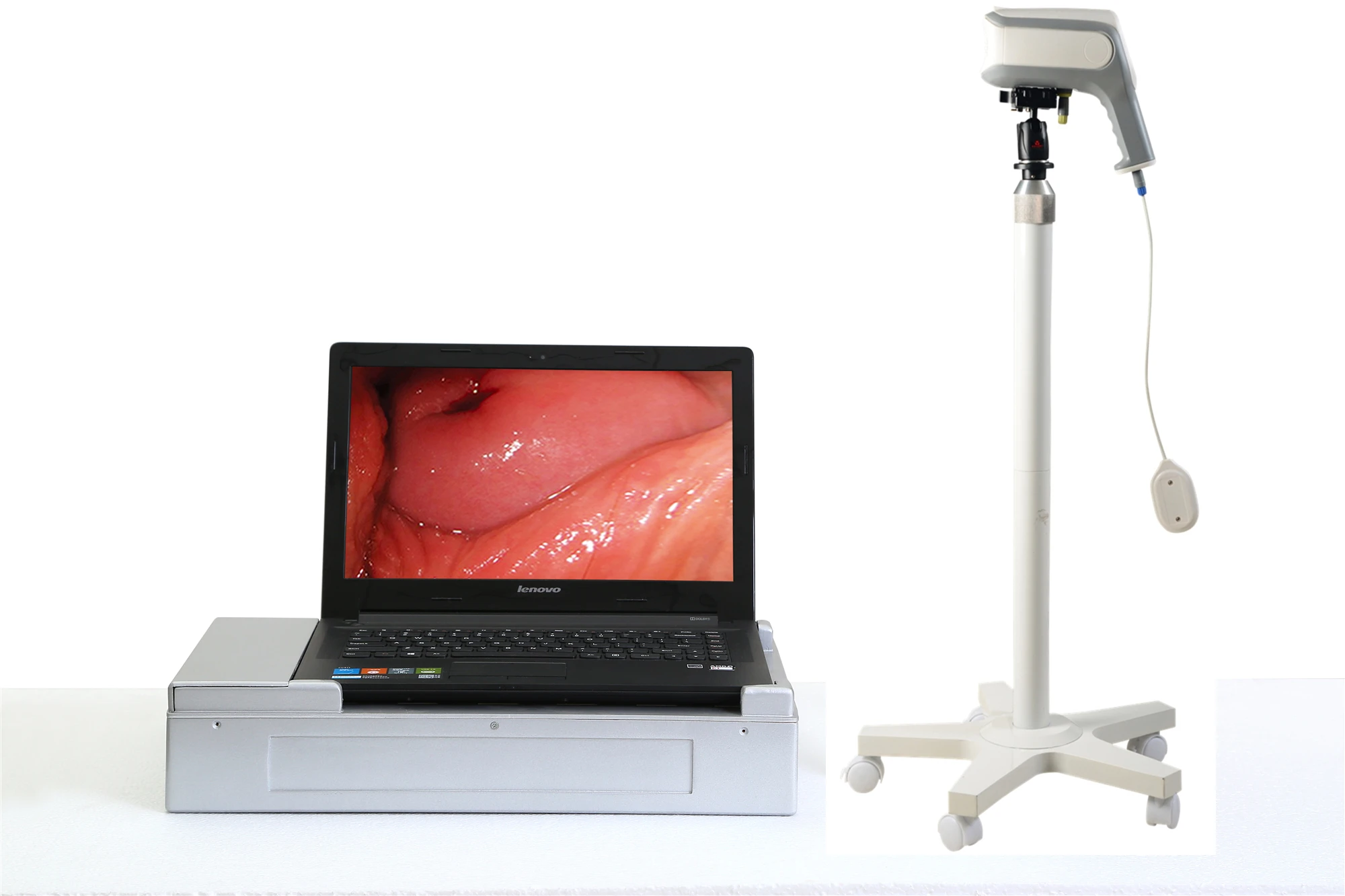 Cheapest handheld portable electronic video colposcope price