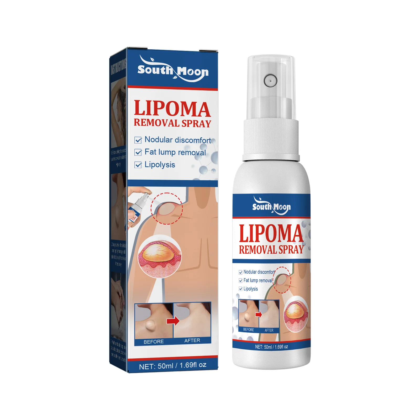 OEM/ODM 50ML Lipoma Removal Spray Cellulite Removing Spray Fat Mass Treatment Medicines Care