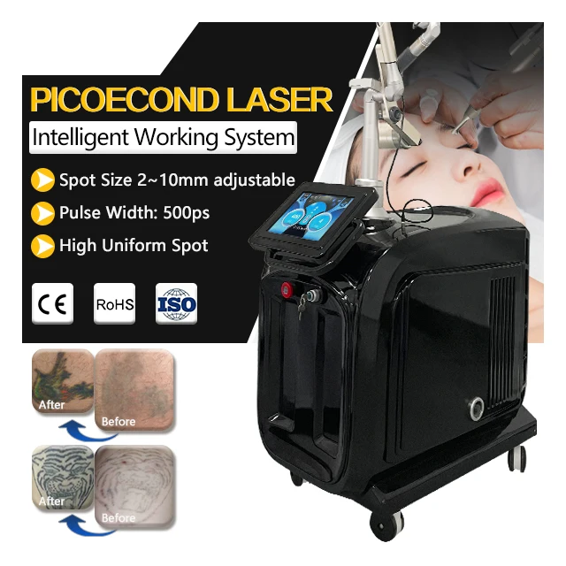 Picosecond 1064 nm 755nm 532nm Pico q switched Nd Yag Laser Pico Laser Tattoo Removal machine price