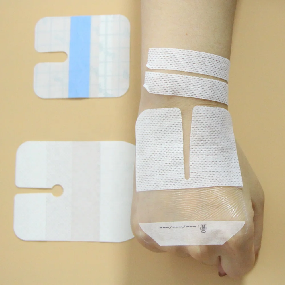 Breathable Surgical Medical Transparent Wound Medical IV Cannula Dressing IV Ported Catheter Cannular Securement Dressing