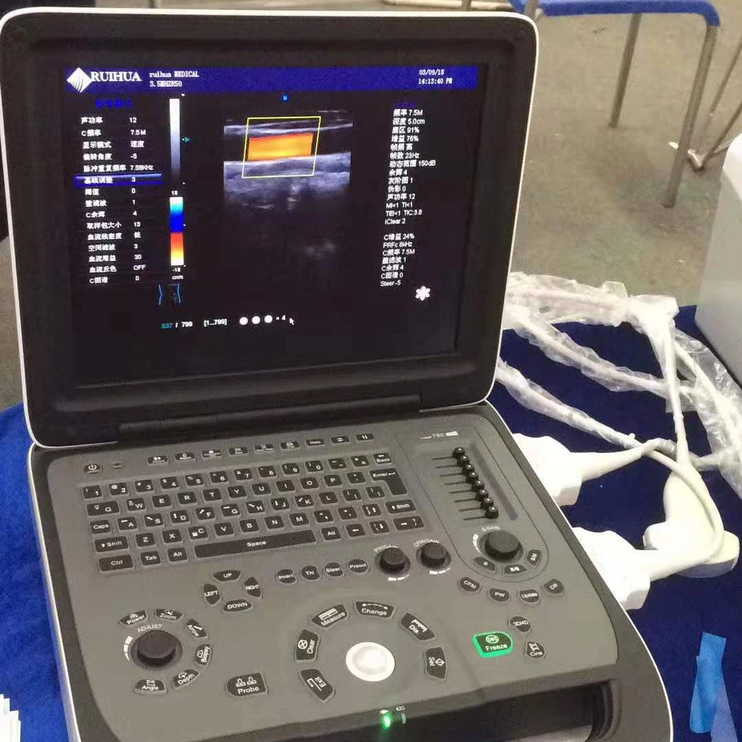 two active probe connectors  Color Doppler Ultrasound laptop convex linear transvaginal