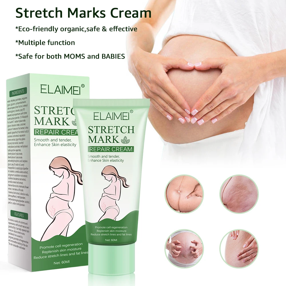 ELAIMEI Beauty Products Anti-Stretch Mark Cream Best Buttock Abdominal Pregnancy Stretch Mark Removal Cream for Legs and Thighs