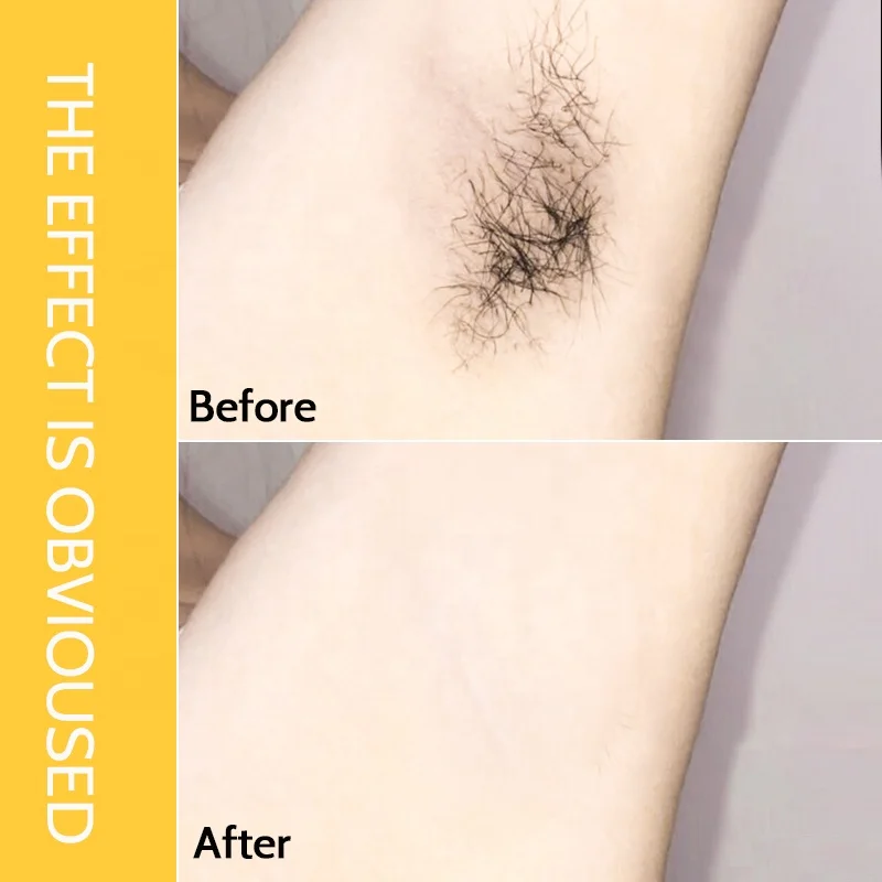 Non-Irritating Quick Removing Hair Depilatory Cream Spray Hair Removal Inhibitor For Body And Face Arm Armpit Leg