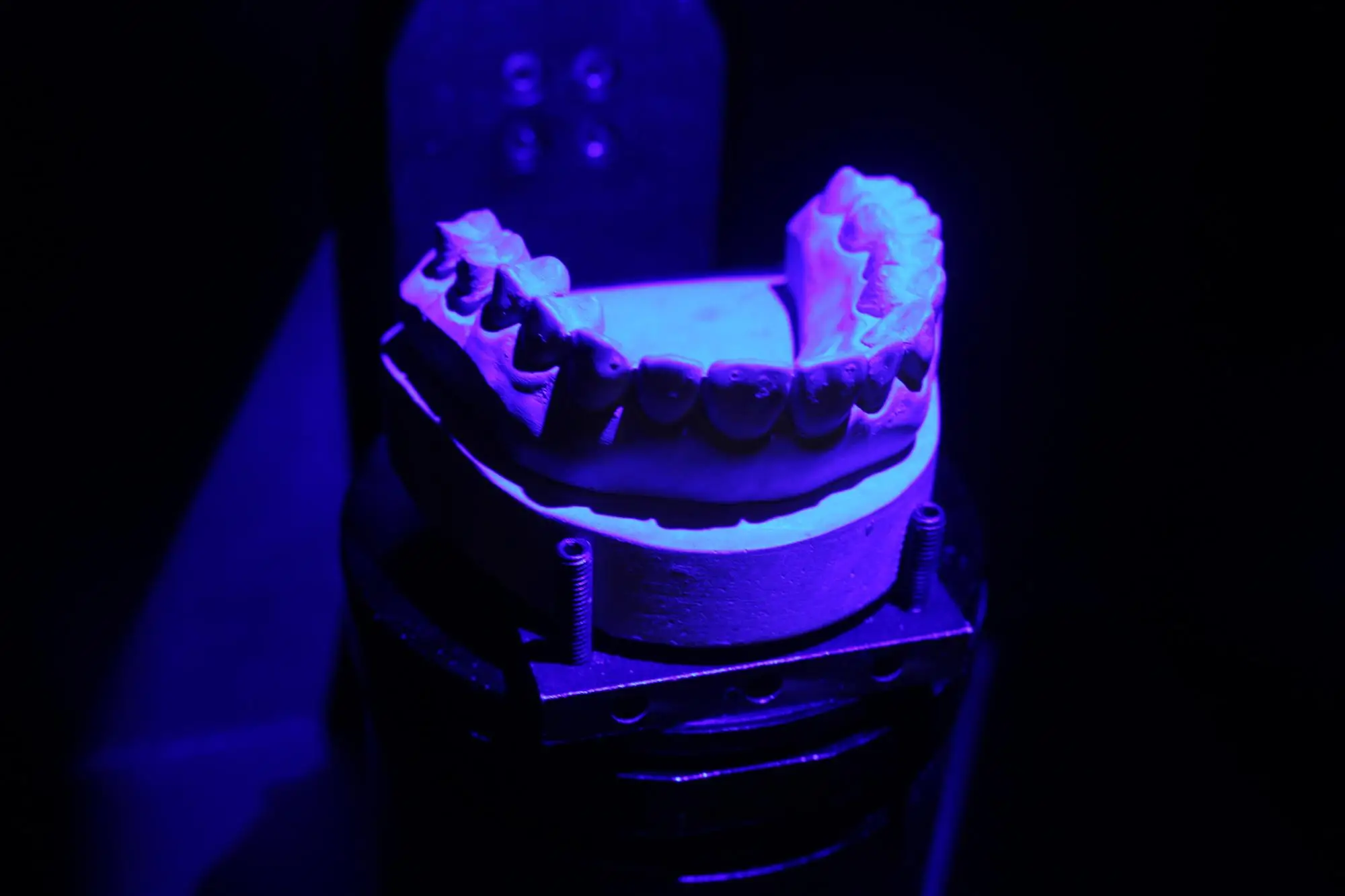 Automatic dental 3D scanner for cnc machine