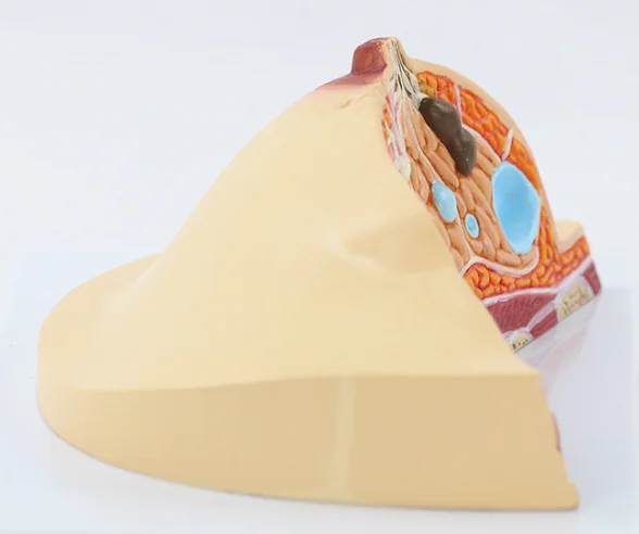 Pathological models of the breast on the anatomy of medical diseases and cancers Models of the female breast