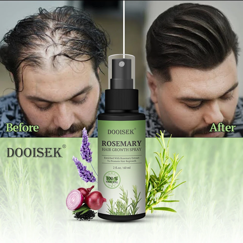 Men Women Anti Hair Loss Hair Growths Spray Private Label  Biotin Hair Growth Serum