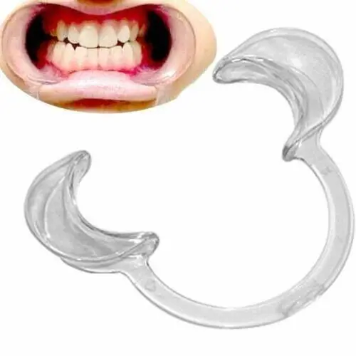 2 Pcs Mouth CShape Opener Dental Cheek Retractor Fun Game Watch Large size