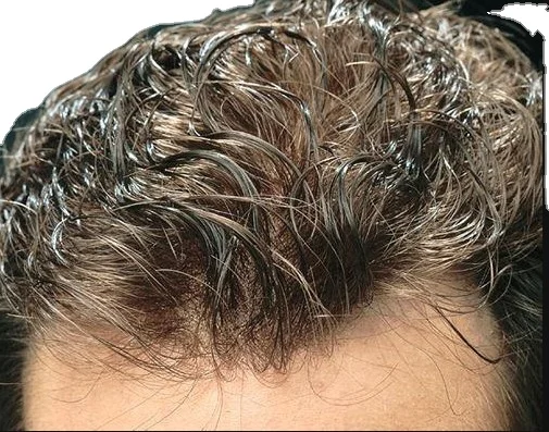 Ultra Thin Skin 0.02-0.04mm V-loop light density , 100%Real Human Hair mens toupee