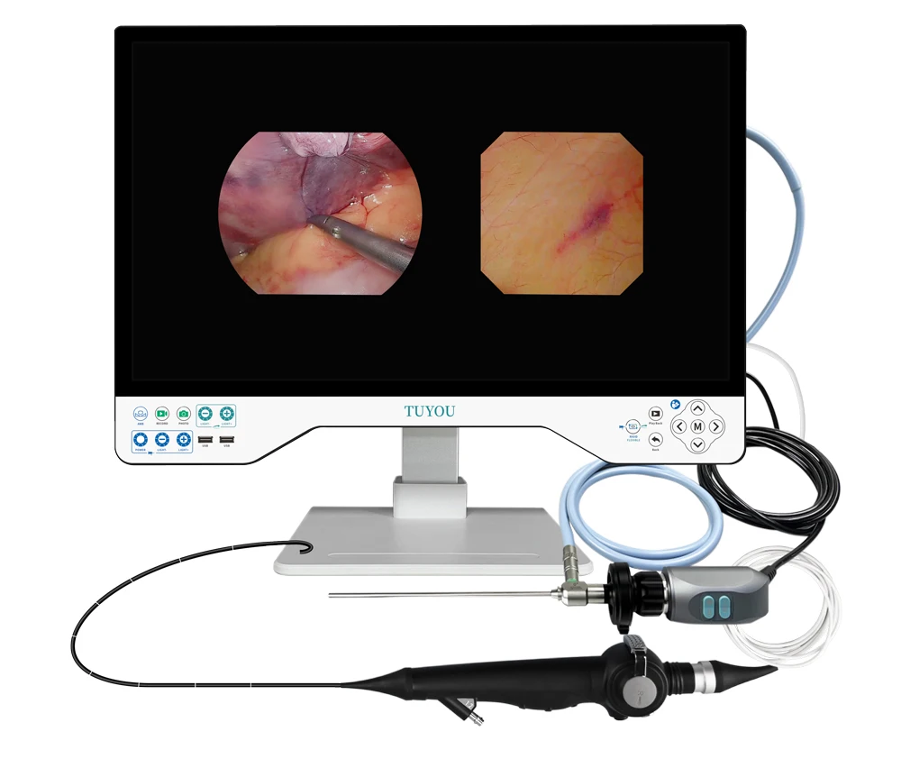 24 Inch 1080P Rigid Flexible  Endoscope Camera System built in  Light Source Record Function all in one endoscope  camera