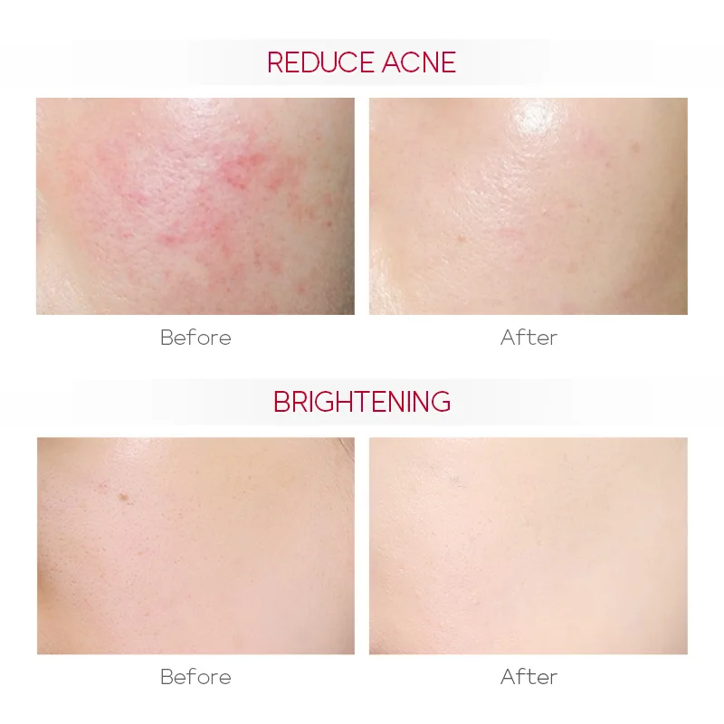 Amide Essence 17ml Moisturizing skin care cosmetics beauty face serum
