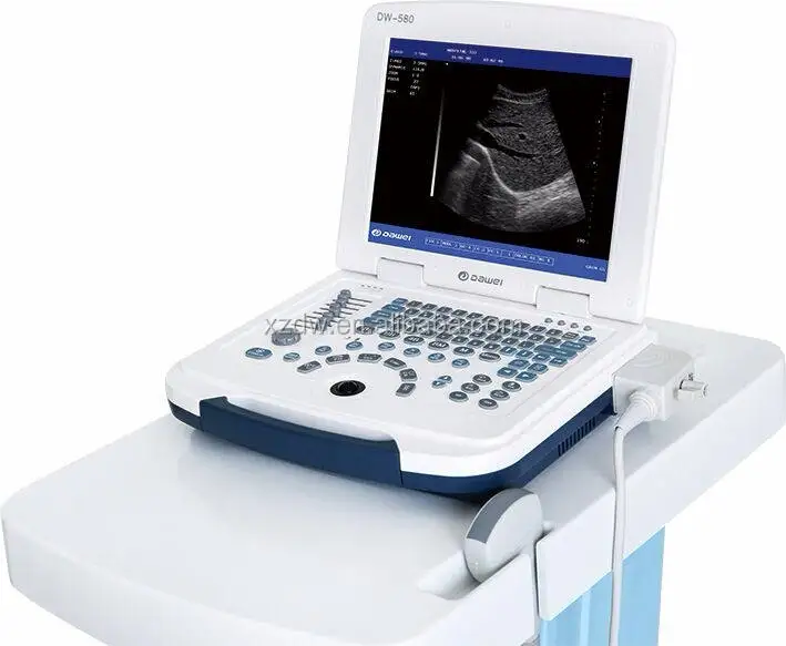 Basic veterinary ultrasound machine for pregnancy test in farms animal ultrasound