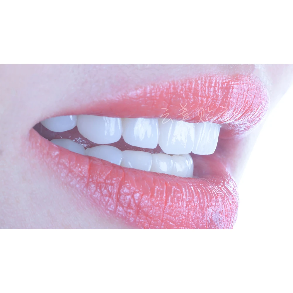 Зубные Улыбки зубы улыбка виниры для макияжа