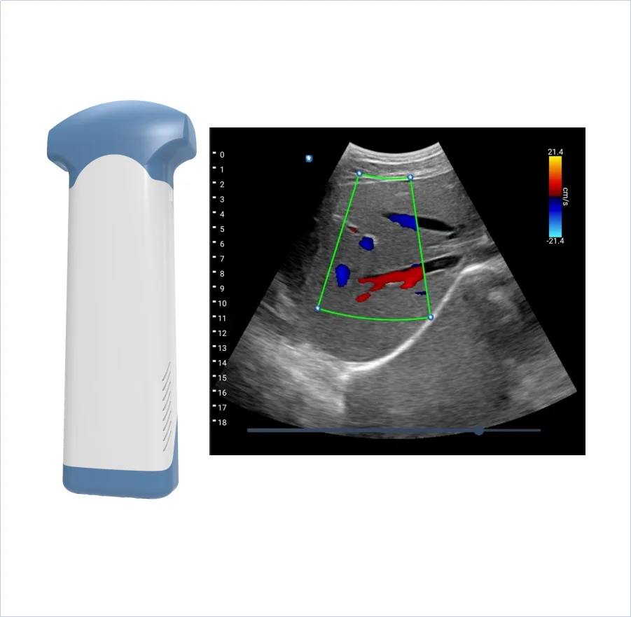 Color Doppler Probe Ultrasound Scanner Portable Wireless Wifi For IOS Android