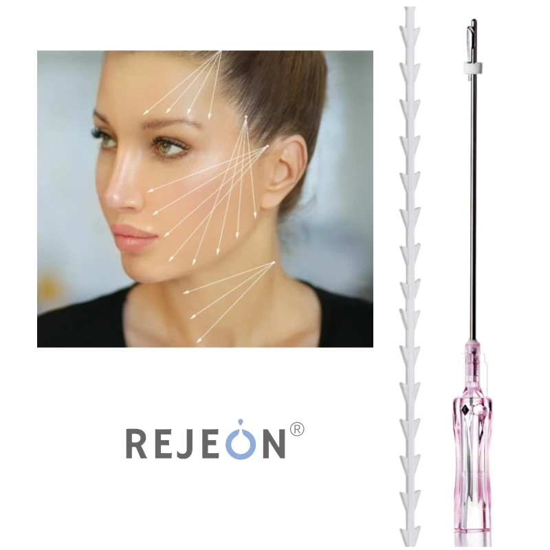 REJEON korean time machine size 60x80 4d cog pdo threads fish bone for facial lift