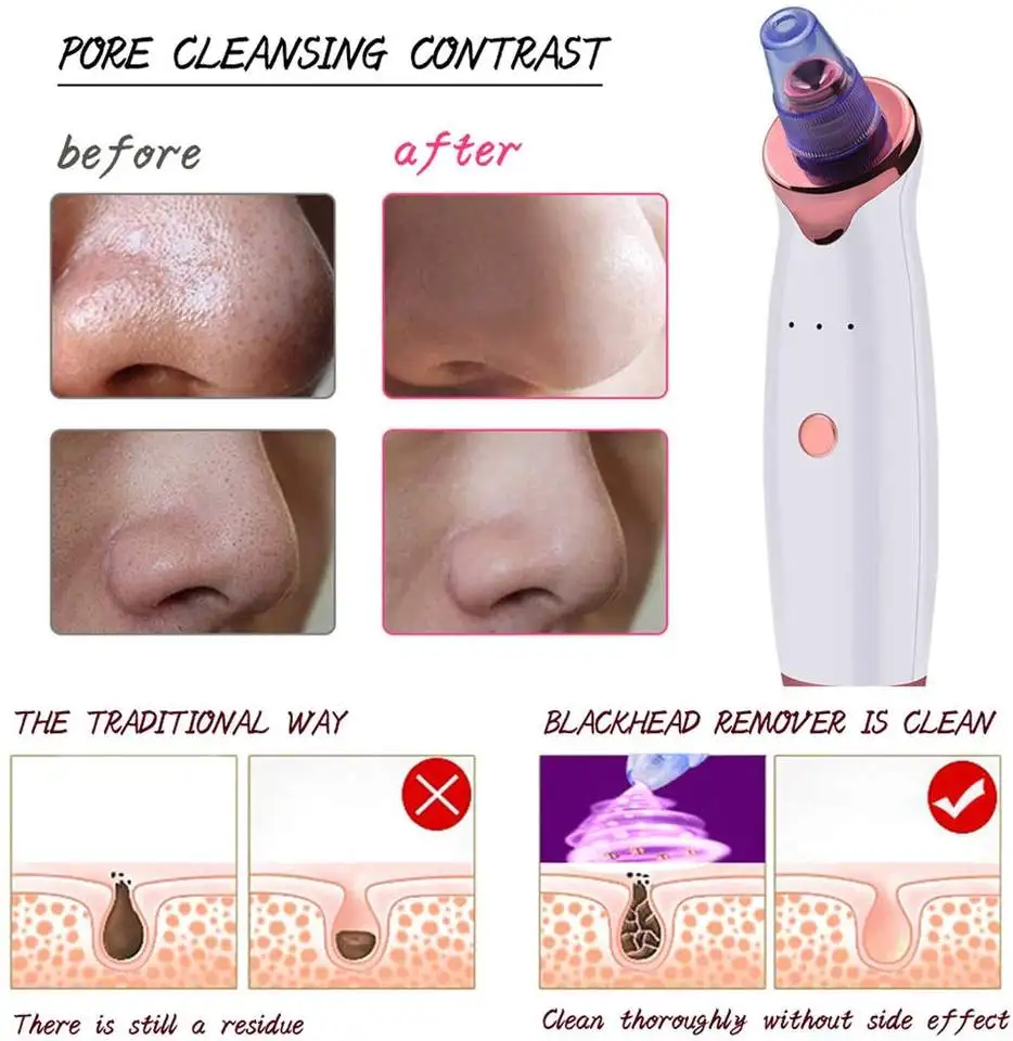 Pimple Removal Machine Black Head Electric Pore Nose Vacuum Blackhead Remover Cleaner Removing Tool With Vacuum Suction