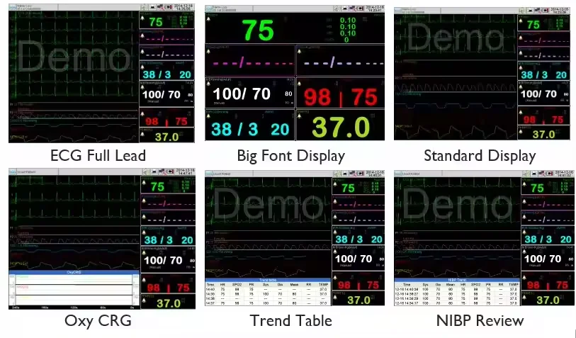 Multifunctional modular plug-in 17-inch touchscreen portable multi-parameter patient monitor