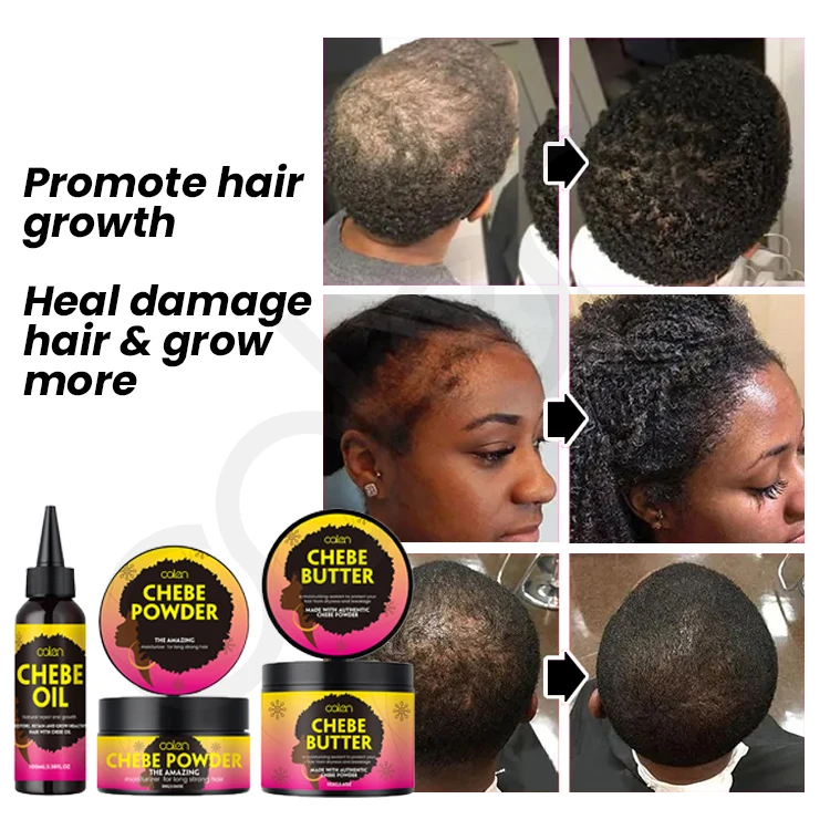 Oalen Private Label 100% Natural Ingredient Hair Care Chebe Powder Oil Butter Chebe Hair Products For Growth