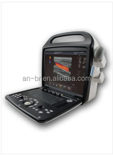
Portable Color Doppler Digital Ultrasound Machine Doppler Ultrasonic Diagnostic 4D Imaging Class II 1 YEAR Optical Imaging 