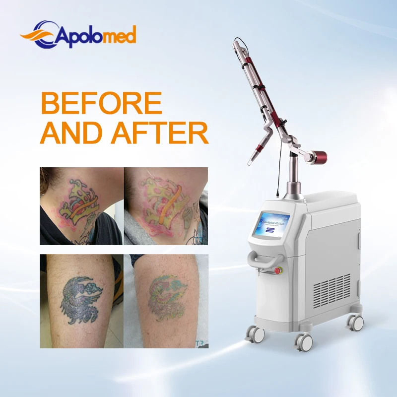 Apolomed Medical 1064 532nm EO q-switch nd yag pico laser tattoo removal equipment Generator of beauty equipment
