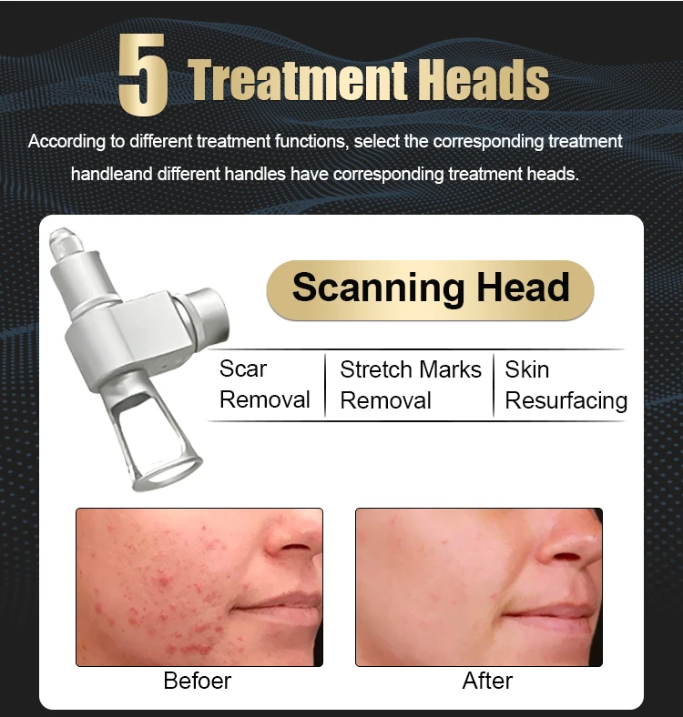 2023 new generation of laser skin rejuvenation colored spot removal stimulate skin in self-healing fractional co2 laser machine
