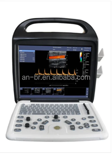
Portable Color Doppler Digital Ultrasound Machine Doppler Ultrasonic Diagnostic 4D Imaging Class II 1 YEAR Optical Imaging 