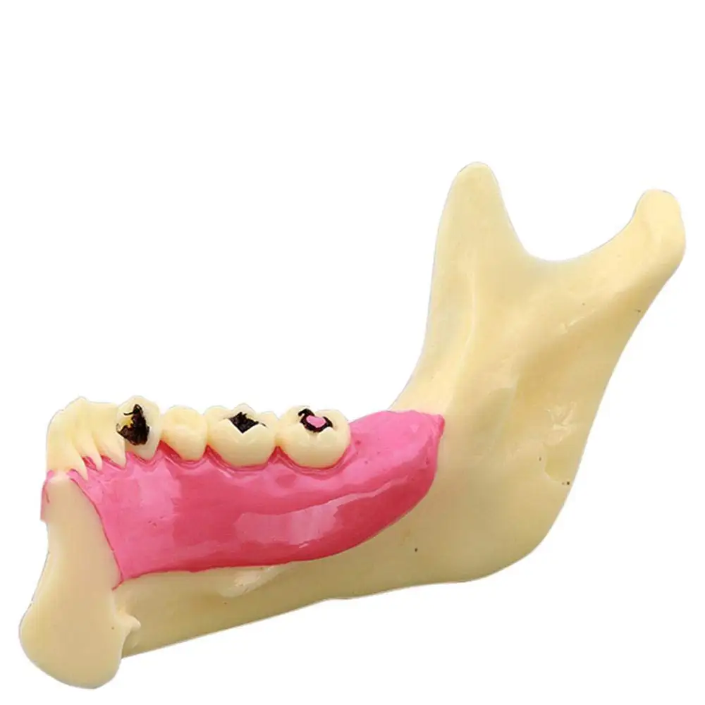 Gelsonlab HSDT-N14 Dental Decomposition Model Organization od Mandible Model