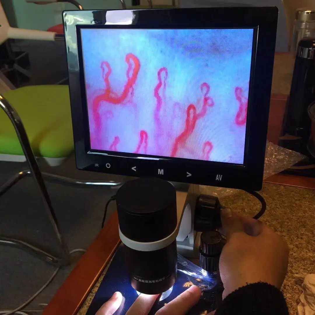 Гироборд с колесами 8 дюймов ЖК-цифровой микроскоп микроциркуляции биологический USB для банка крови дисплей nailfold капиллярные