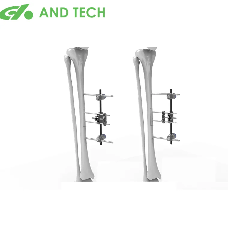 И от китайского производителя tech 8 мм фиксатор для внешней фиксации набор инструментов с большими