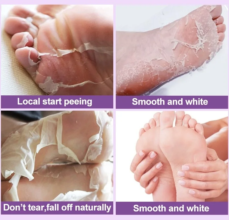 Wholesale Foot Scrub Exfoliating Private Label Heel Therapy Peal Mask Pedicure Repair Plantifique Peel off Skin