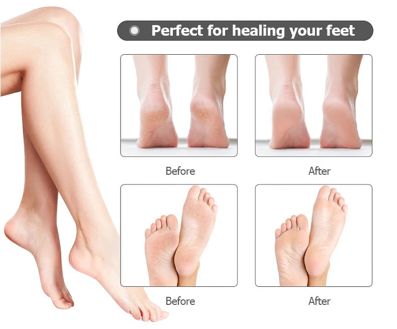 New trend product electric Callus Remover Machine Feet Removes Calluses foot grinder machine