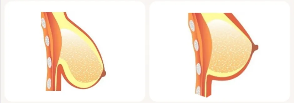 
Natural Flavor Woman Care Big Chest Firming Gel Names Breast Tightening Cream 