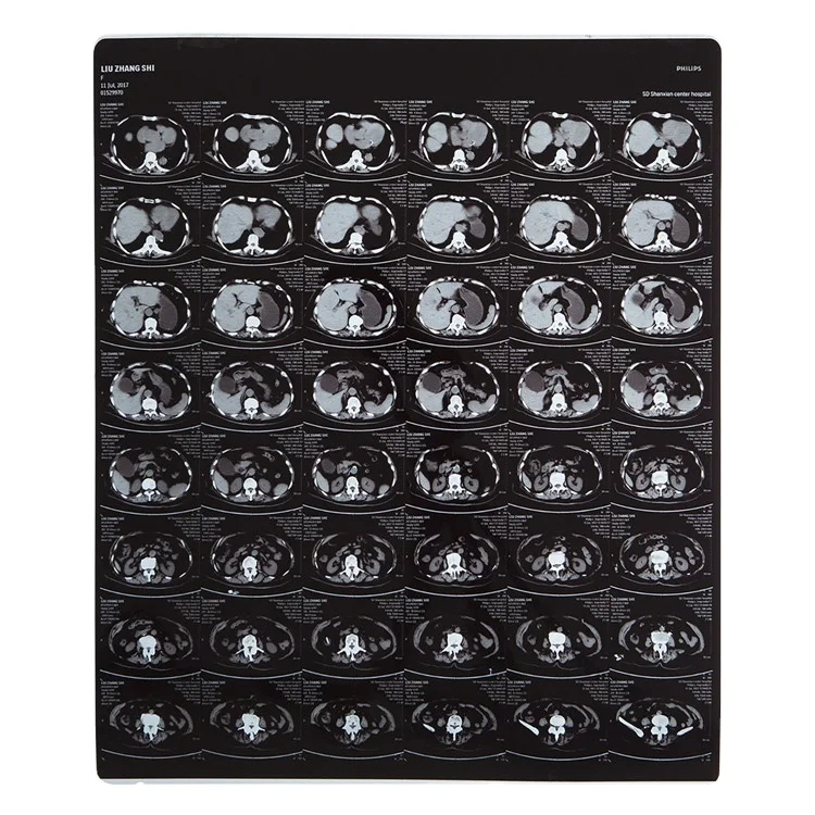 FujiFilm DI-HT Fuji 8x10 10x14 14x17inch Medical Dry Thermal Imaging x-ray Film