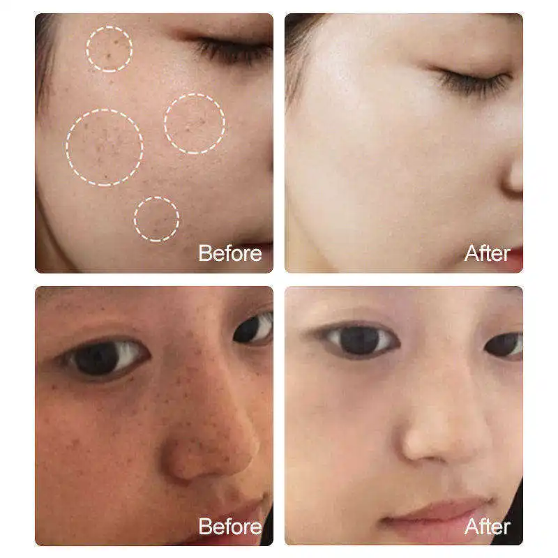 private label face glowing anti-aging serum niacinamide acne dark spot remove whitening serum skin care for brightening