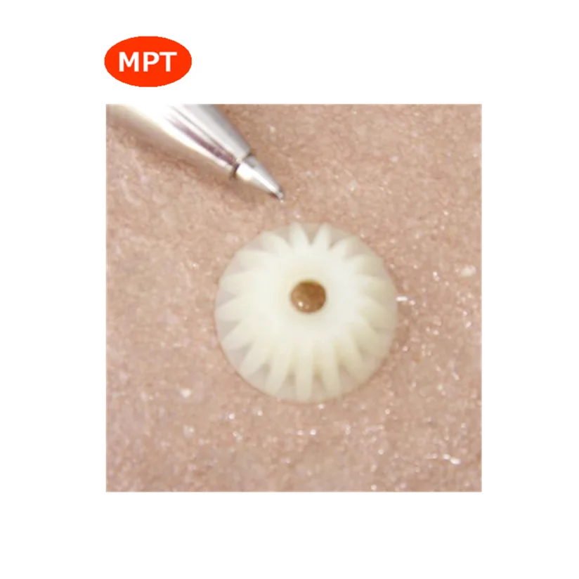 Изготовление пластиковых конических зубцов с помощью литья под давлением с 1999 года хорошего качества