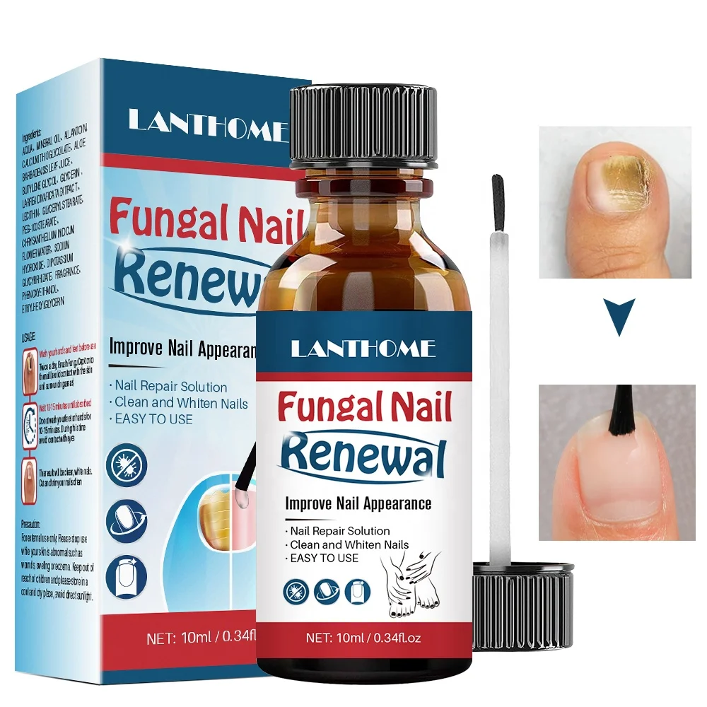 Anti Fungal Nail Foot Care Nail Fungus Pedicure Treatment Home Nail Fungus Treatment Oil Liquid Solution Kit