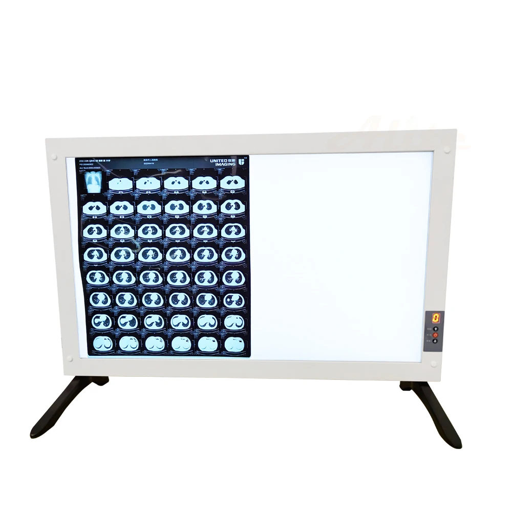 High Brightness Medical Hospital Equipment LED X Ray Film Viewer Dimmable 110V 240V Smart Sensor LED Negatoscope