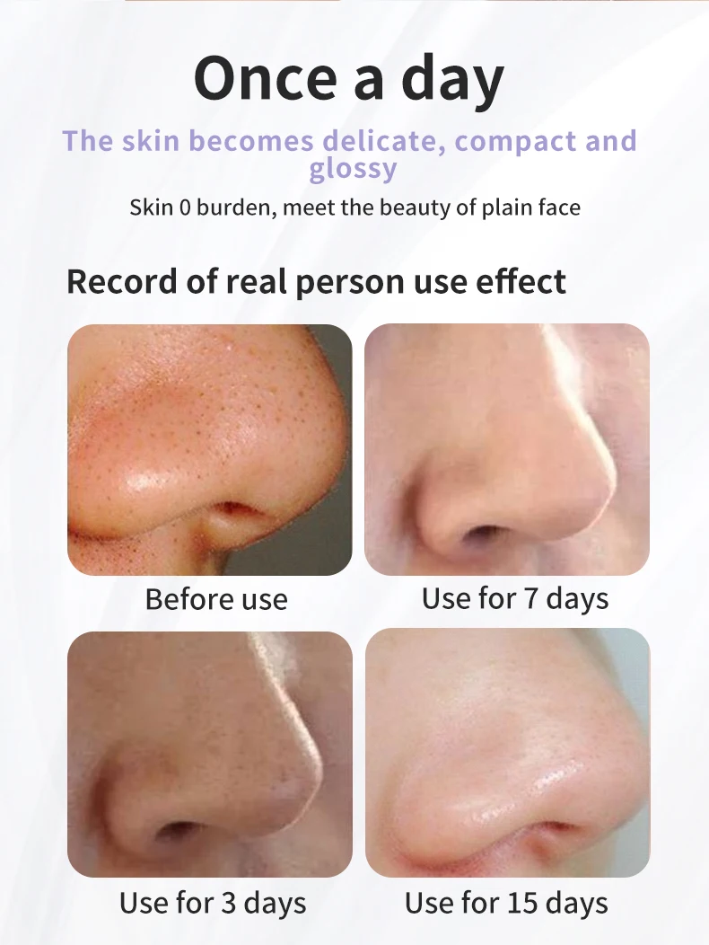 Beauty Product Facial Cleaner Electric Micro Small Bubble Water Cycle Acne Pore Vacuum Blackhead Remover Device