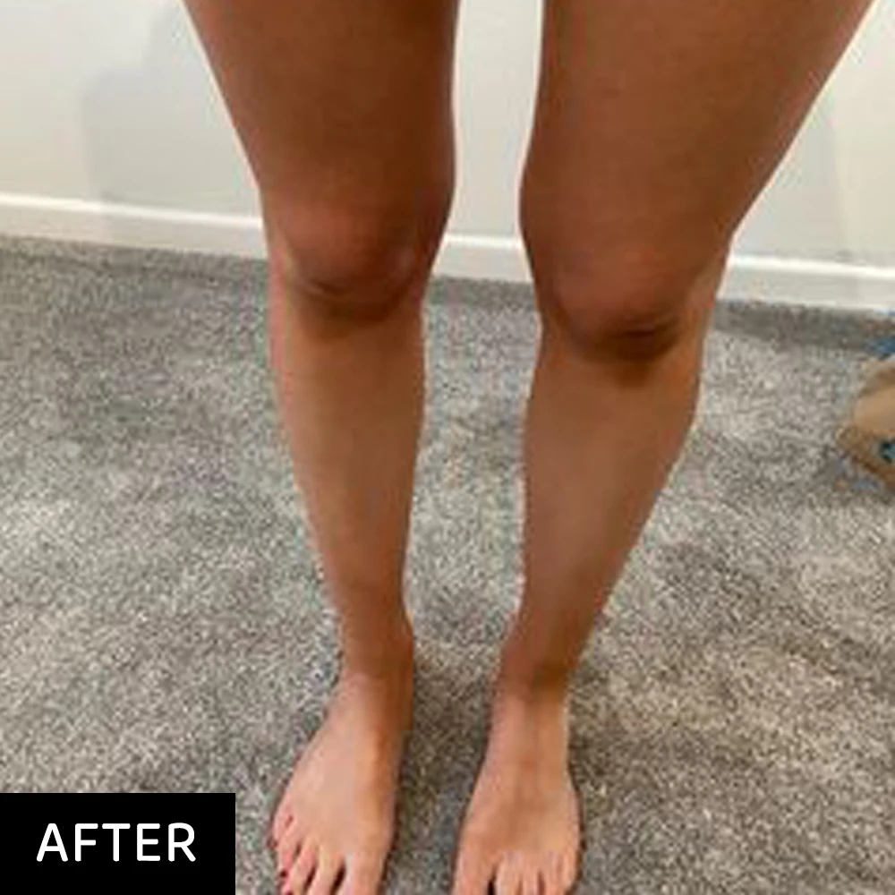 Custom Logo Tanning-Products Vegan Coconut Instant Fake Bronzer Self Tan Mousse Sun Outdoor Tanning Foam