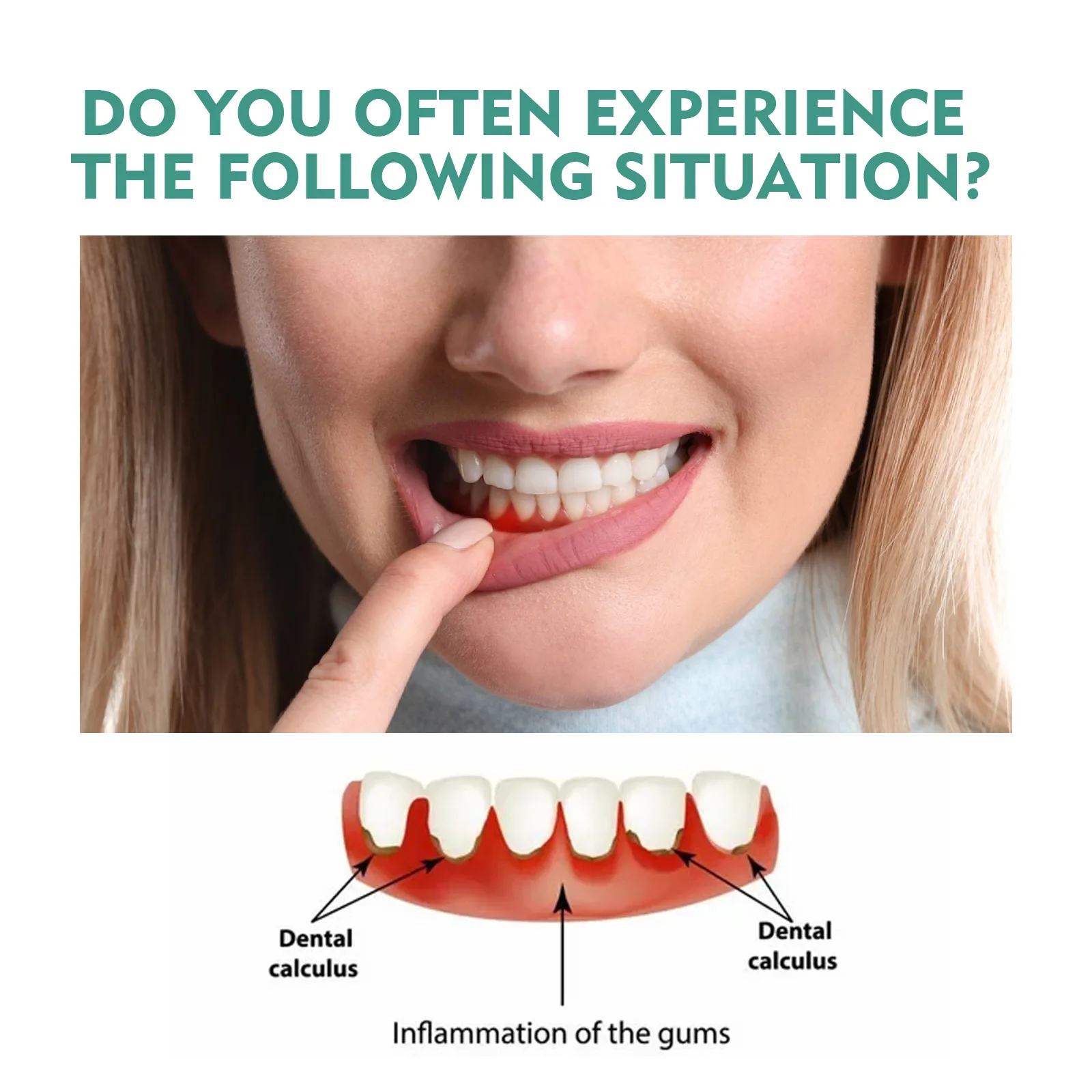 Relieve Toothache Oral Pain Periodontal Gum Pain Aphthous Ulcers Blistering with This Antibacterial Oral Care Spray Solution