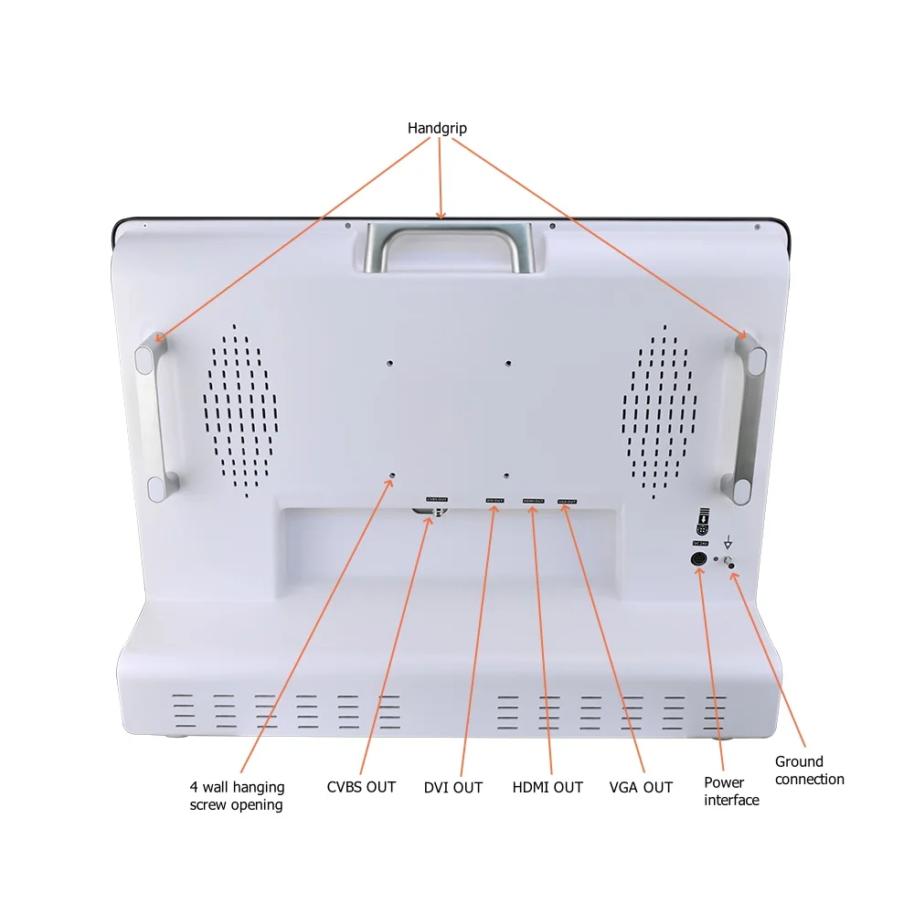 Portable medical UHD endoscope system, check all-in-one otolaryngology endoscopic surgery with a 24-inch monitor
