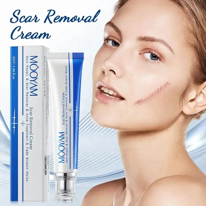 Fastest Acne Scar Removal Cream Face Care Scar Gel Bruise Repair Cream Tummy Tuck Tightening 30g Stretch Mark Scar Removal Cream