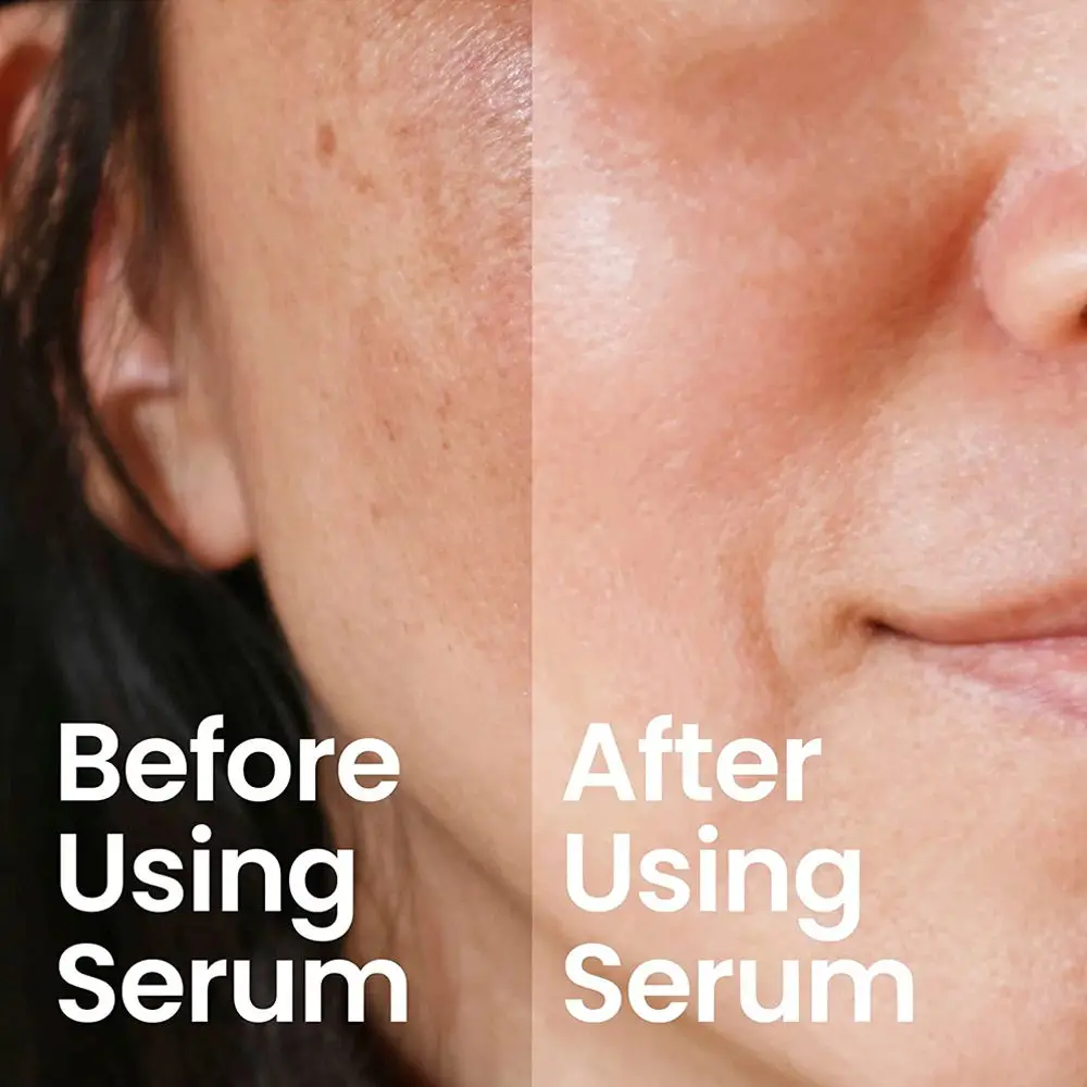 Wholesale Skin Care 5 In 1 30% Vitamin C Whitening Hyaluronic Acid Anti Aging Face Serum 5% Niacinamide Collagen Facial Serum