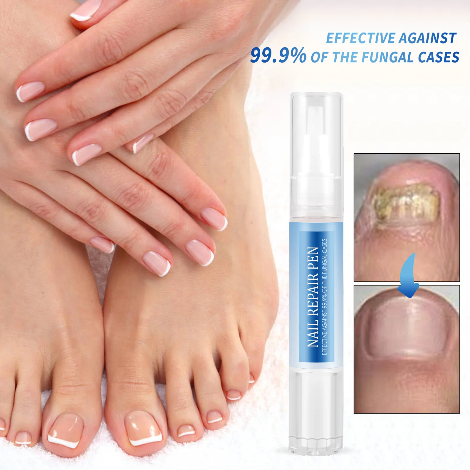 New Products Beauty Personal Care Nails Provide Nutrition Nail Care Oil Essence Kit Fungal Nail Repair Pen