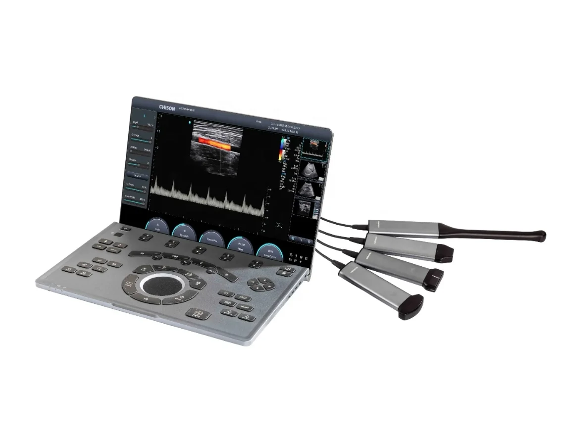 Chison Sonoair Portable machine color doppler ultrasound machine Medical Ultrasound system Scanner Sonoair70