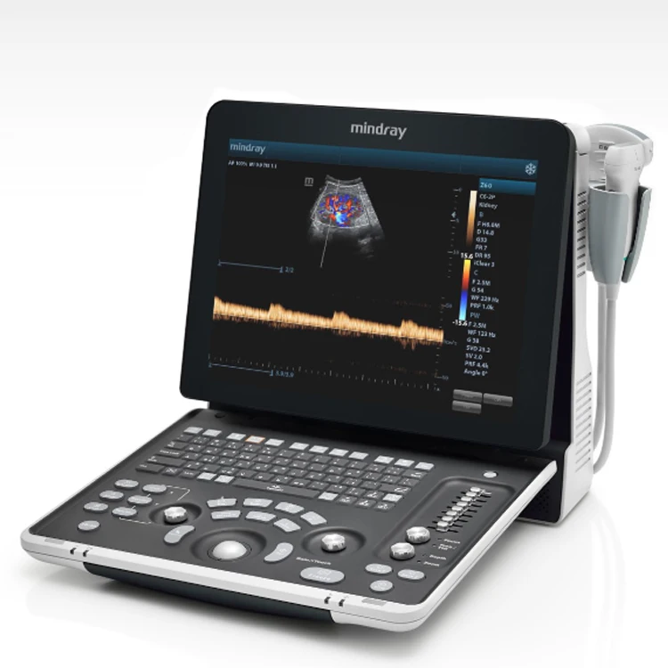 Mindray Z60 Vet Portable Veterinary Ultrasonic Diagnostic Imaging Color Doppler System Animal