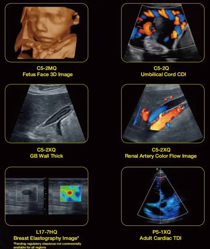 Edan Ax8 Portable Ultrasound Scanner Color Doppler Brand New Ax3/Ax4/Ax8 Price