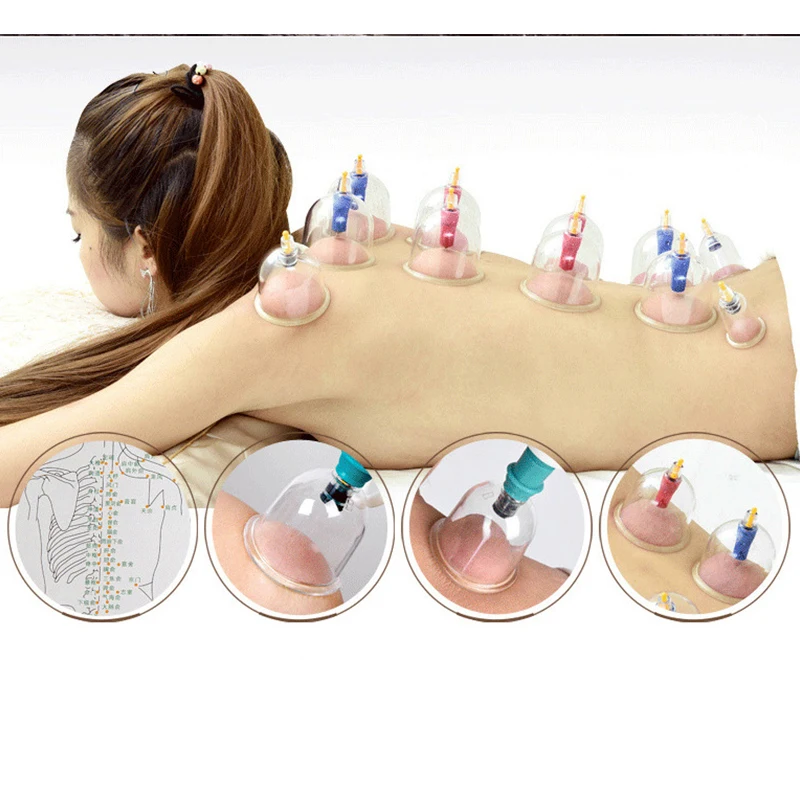 Горячая Распродажа, Китайская традиционная Вакуумная чашка-баночка hijama с небольшим насосом ABS
