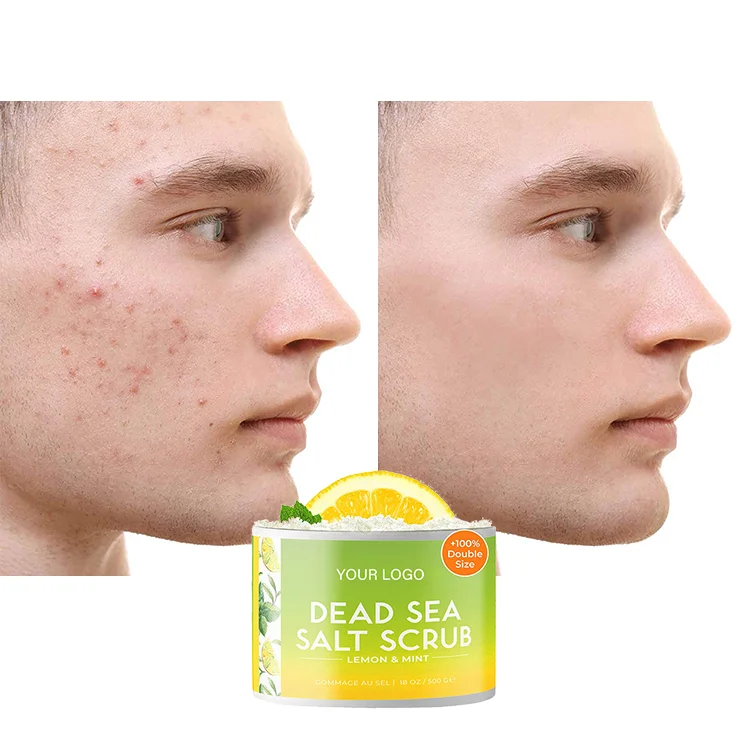 24K Gold Vitamin E Face Cream Super Eclaircissant Diamond Gluthatio Comprime Freckle Removing Whitening Cream